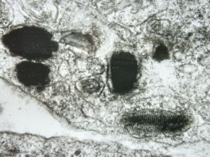 promelanosome and melanosomes